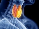 ThyroidDiseases